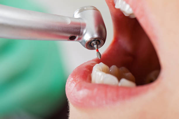 Best Weekend Emergency Dentist in Quail Ridge, FL
